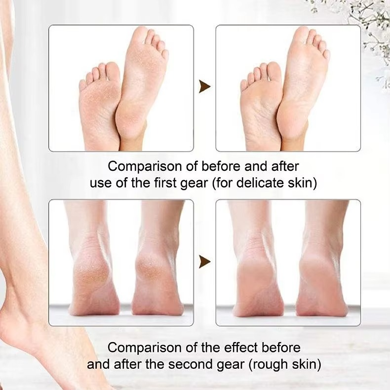 Heel Healer