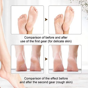 Heel Healer